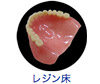 レジン床義歯